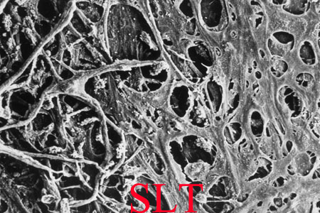 SLT